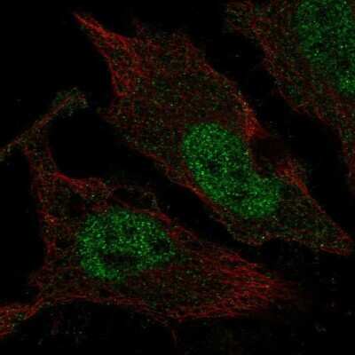 Immunocytochemistry/ Immunofluorescence: TLX3 Antibody [NBP2-68767]