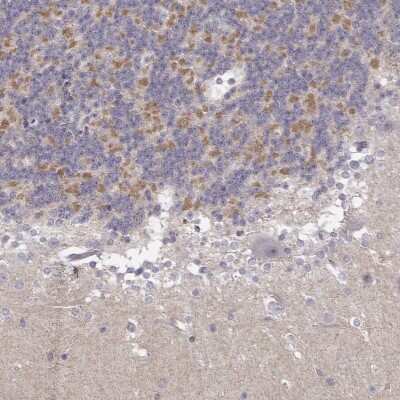 Immunohistochemistry: TLX3 Antibody [NBP2-68882]