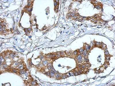 Immunohistochemistry-Paraffin: Fibulin 7 Antibody [NBP2-20659]