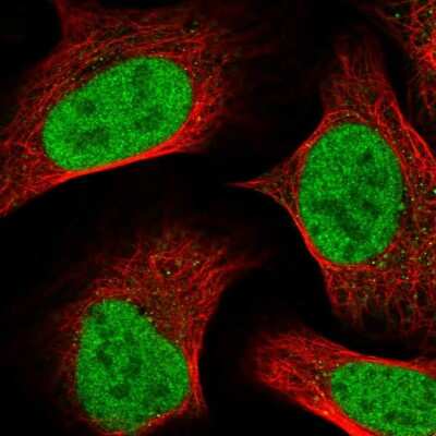 Immunocytochemistry/ Immunofluorescence: TM2D1 Antibody [NBP2-13436]