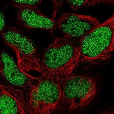 Immunocytochemistry/ Immunofluorescence: TM2D1 Antibody [NBP2-55760]