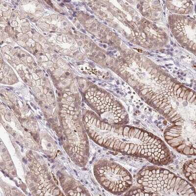 Immunohistochemistry-Paraffin: TM2D1 Antibody [NBP2-13436]