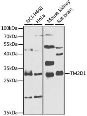 Western Blot: TM2D1 AntibodyBSA Free [NBP2-94311]