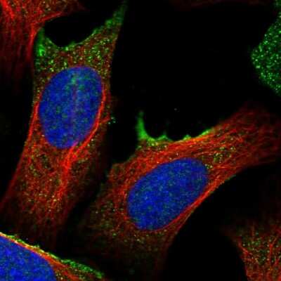 Immunocytochemistry/ Immunofluorescence: TM2D2 Antibody [NBP2-30917]