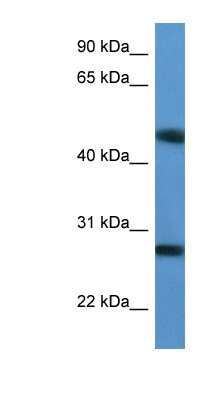 Western Blot: TM2D2 Antibody [NBP1-79845]