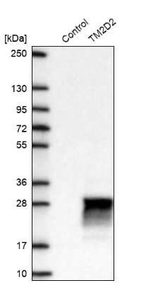 Western Blot: TM2D2 Antibody [NBP2-30462]