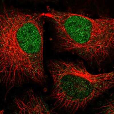 Immunocytochemistry/ Immunofluorescence: TM2D3 Antibody [NBP2-30535]