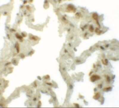Immunohistochemistry-Paraffin: TM4SF1/L6 Antibody - BSA Free [NBP1-76549]