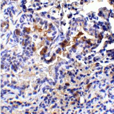 Immunohistochemistry-Paraffin: TM4SF1/L6 Antibody - BSA Free [NBP1-76549]