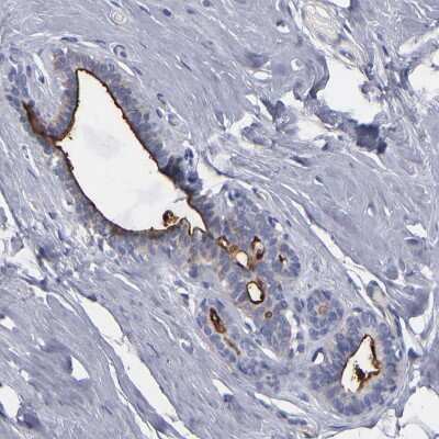 Immunohistochemistry-Paraffin: TM4SF1/L6 Antibody [NBP1-82854]