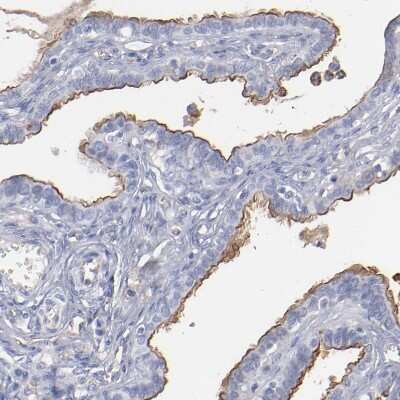Immunohistochemistry-Paraffin: TM4SF1/L6 Antibody [NBP1-82854]
