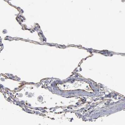 Immunohistochemistry-Paraffin: TM4SF1/L6 Antibody [NBP1-82854]