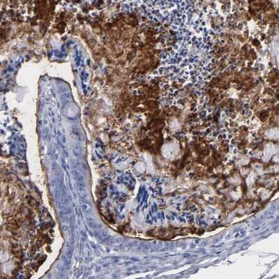 Immunohistochemistry-Paraffin: TM4SF1/L6 Antibody [NBP1-82854]