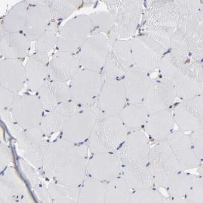 Immunohistochemistry-Paraffin: TM4SF1/L6 Antibody [NBP1-82854]