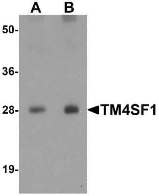 Western Blot: TM4SF1/L6 AntibodyBSA Free [NBP1-76549]