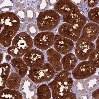 Immunohistochemistry-Paraffin: TM4SF18 Antibody [NBP2-57543]