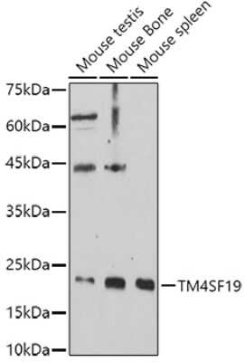 Western Blot: TM4SF19 AntibodyAzide and BSA Free [NBP3-16026]