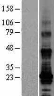 Western Blot: TM4SF19 Overexpression Lysate [NBL1-16964]