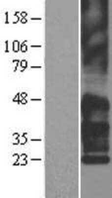 Western Blot: TSPAN7/TM4SF2 Overexpression Lysate [NBL1-17381]