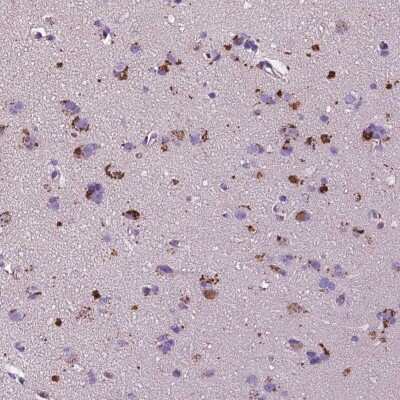 Immunohistochemistry: TM4SF20 Antibody [NBP2-49388]