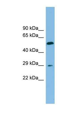 Western Blot: TM4SF20 Antibody [NBP1-59848]