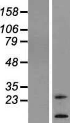 Western Blot: TM4SF20 Overexpression Lysate [NBL1-16965]