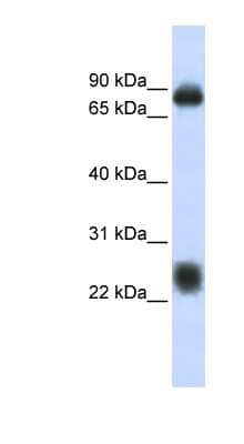 Western Blot: TSPAN8/TM4SF3 Antibody [NBP1-62380]