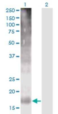 Western Blot: TM4SF4 Antibody (4E6) [H00007104-M03]