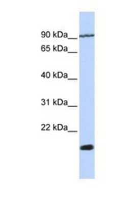 Western Blot: TM4SF4 Antibody [NBP1-69647]