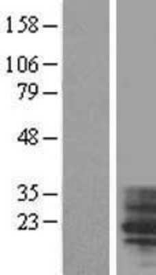 Western Blot: TM4SF4 Overexpression Lysate [NBL1-16966]