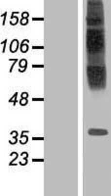 Western Blot: TM6SF1 Overexpression Lysate [NBP2-06368]