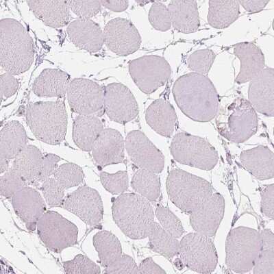 Immunohistochemistry-Paraffin: TM6SF2 Antibody [NBP2-49469]