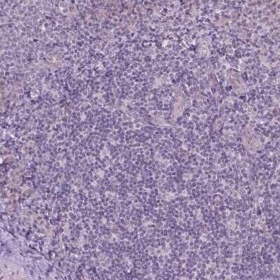 Immunohistochemistry-Paraffin: TM6SF2 Antibody [NBP2-49469]