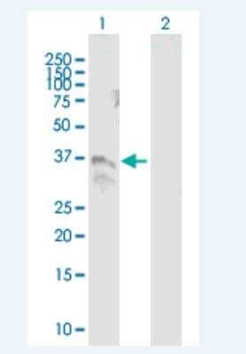 Western Blot: TM6SF2 Antibody [H00053345-B01P-50ug]