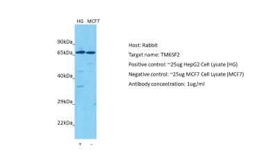 Western Blot: TM6SF2 Antibody [NBP2-85928]