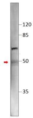 Western Blot: TM6SF2 Antibody [NBP3-12197]