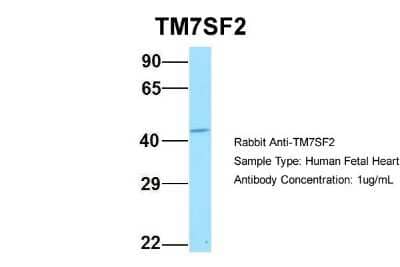 Western Blot: TM7SF2 Antibody [NBP1-80548]