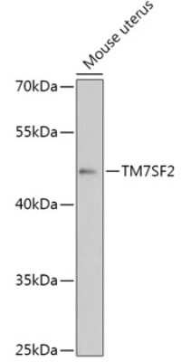 Western Blot: TM7SF2 AntibodyAzide and BSA Free [NBP2-93095]