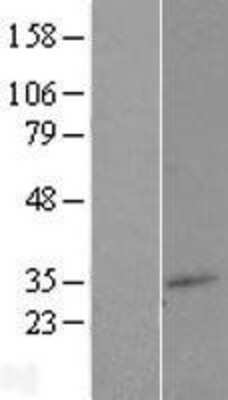 Western Blot: TM7SF2 Overexpression Lysate [NBP2-08024]