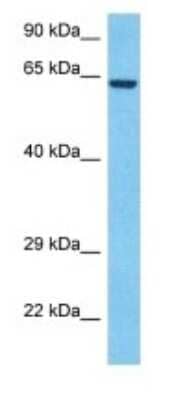 Western Blot: TM7SF3 Antibody [NBP3-09232]