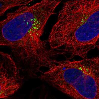 Immunocytochemistry/ Immunofluorescence: TM9SF1 Antibody [NBP2-32445]