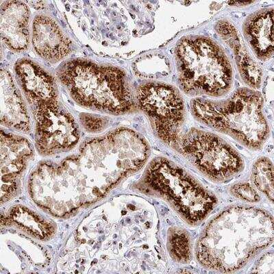 Immunohistochemistry-Paraffin: TM9SF1 Antibody [NBP2-32445]