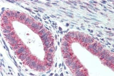 Immunohistochemistry-Paraffin: TM9SF1 Antibody [NBP3-14497]