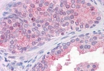 Immunohistochemistry-Paraffin: TM9SF1 Antibody [NBP3-14498]