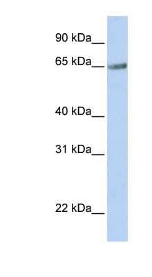 Western Blot: TM9SF1 Antibody [NBP1-62531]