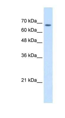 Western Blot: TM9SF1 Antibody [NBP1-62532]