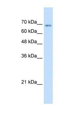 Western Blot: TM9SF1 Antibody [NBP1-69486]