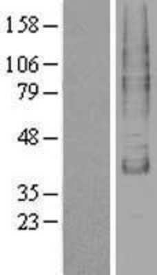 Western Blot: TM9SF1 Overexpression Lysate [NBP2-04310]