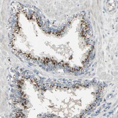 Immunohistochemistry-Paraffin: TM9SF2 Antibody [NBP1-80958]