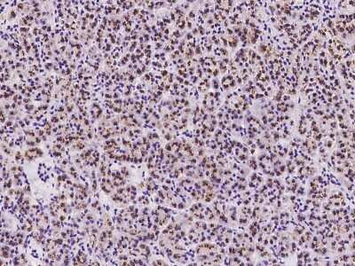 Immunohistochemistry-Paraffin: TM9SF2 Antibody [NBP2-98514]